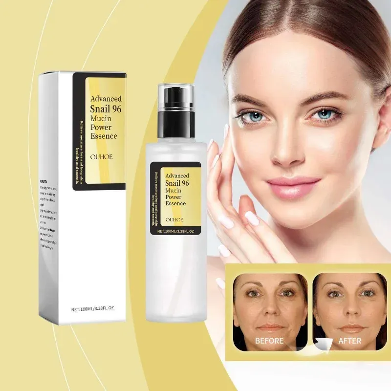 스네일 96 뮤신 수분 광채 에센스